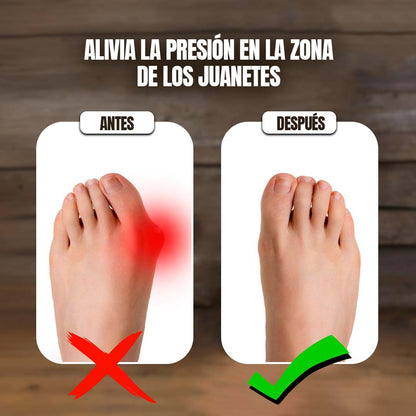 SANDALIAS CONFY ORTOPÉDICA CUIDA JUANETES ??ENVÍO GRATIS??